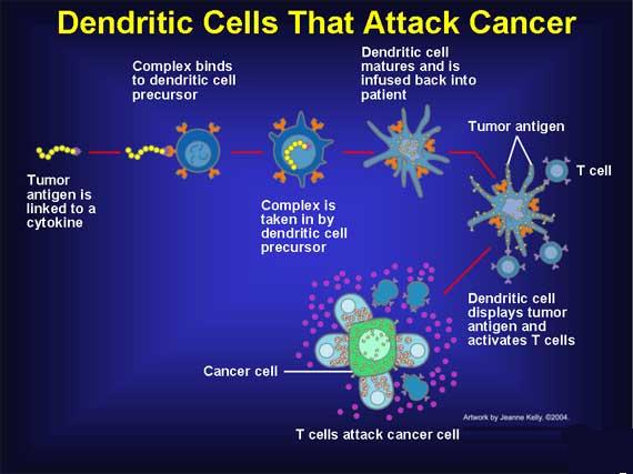 Dendritic cell therapy